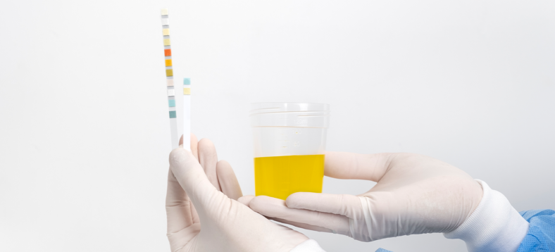 urine_testing